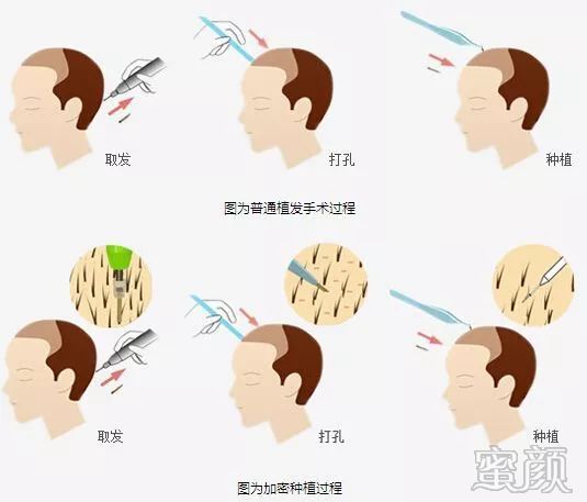 案例图片