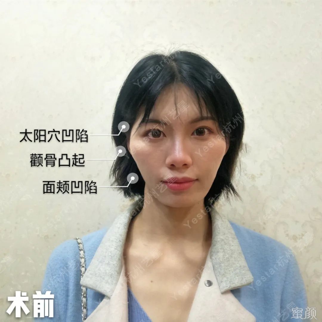 案例图片