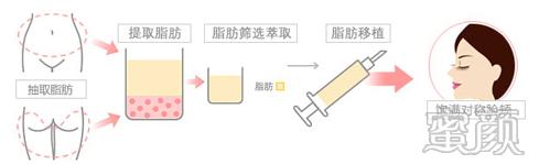 案例图片