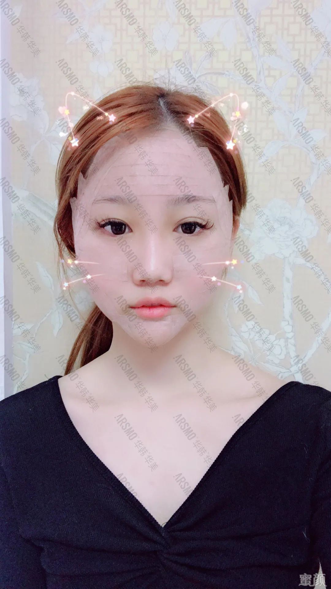 https://img.yiyiaimei.com/mnt/timg/200415/134H95596-7.jpg 案例图片