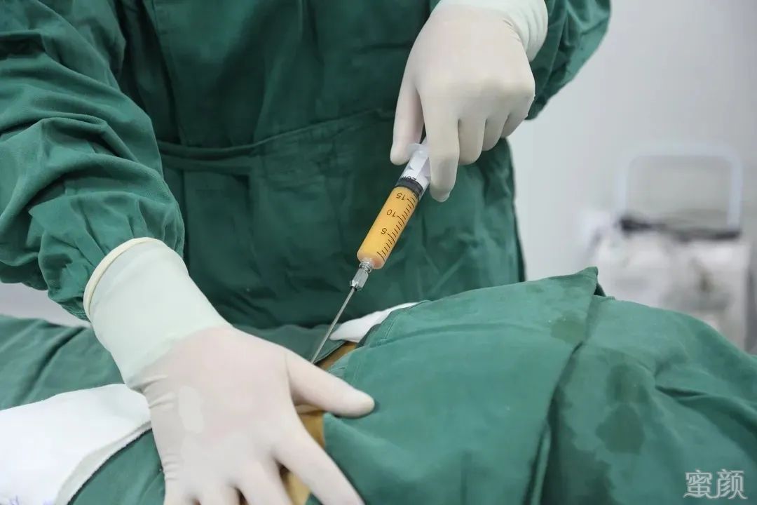 https://img.yiyiaimei.com/mnt/timg/200415/134HW507-4.jpg 案例图片