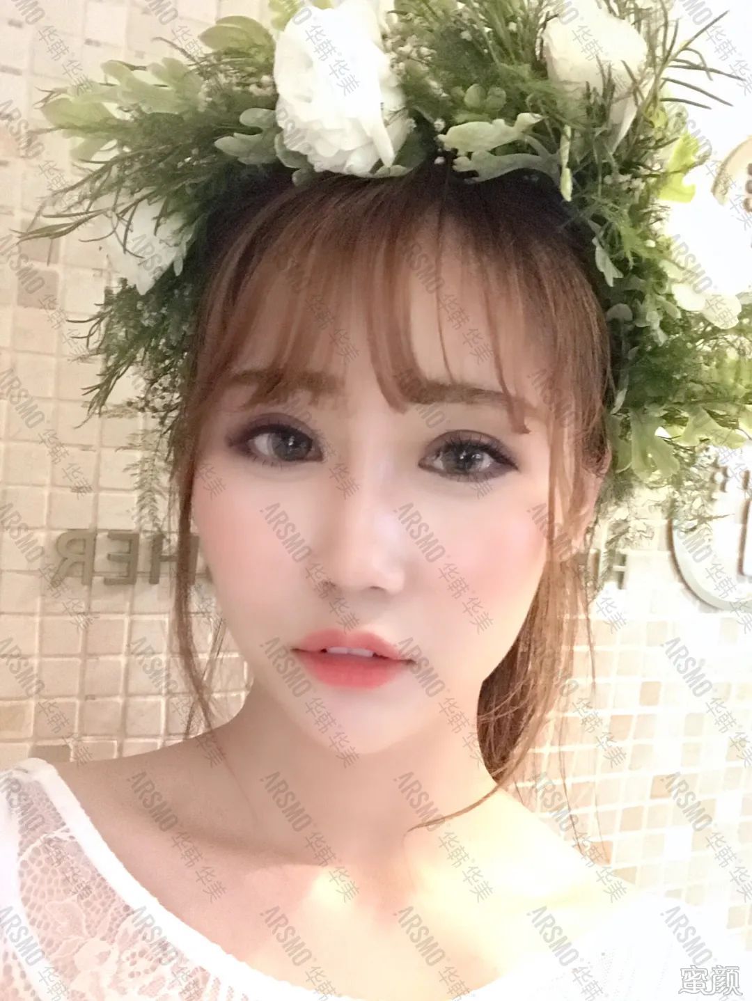 https://img.yiyiaimei.com/mnt/timg/200415/134I34395-10.jpg 案例图片