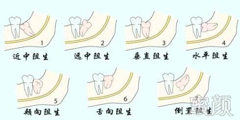 案例图片