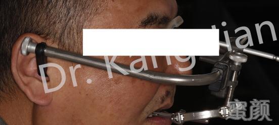 https://img.yiyiaimei.com/mnt/timg/200415/1414201442-14.jpg 案例图片