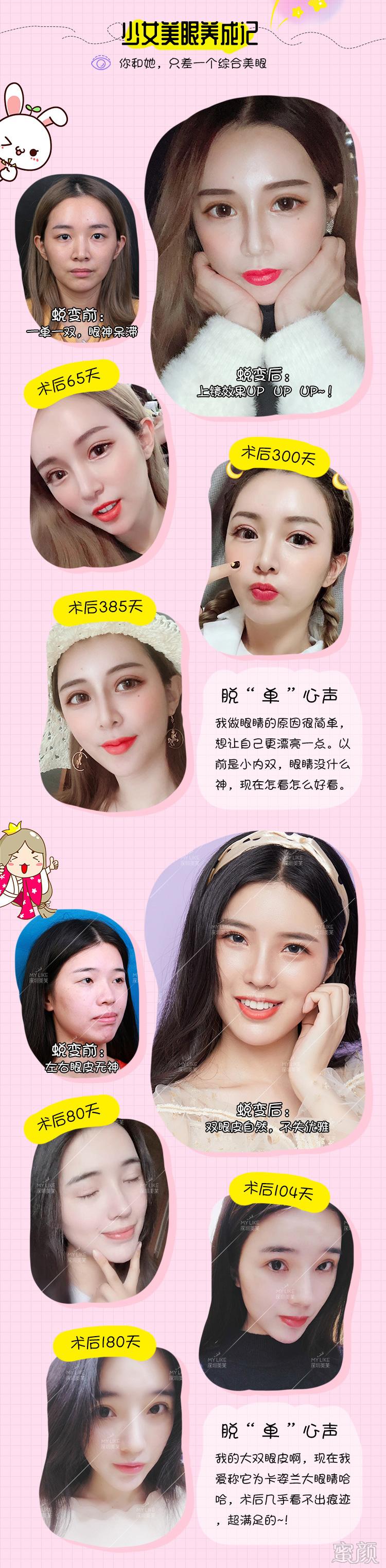 https://img.yiyiaimei.com/mnt/timg/200415/144I92C0-7.jpg