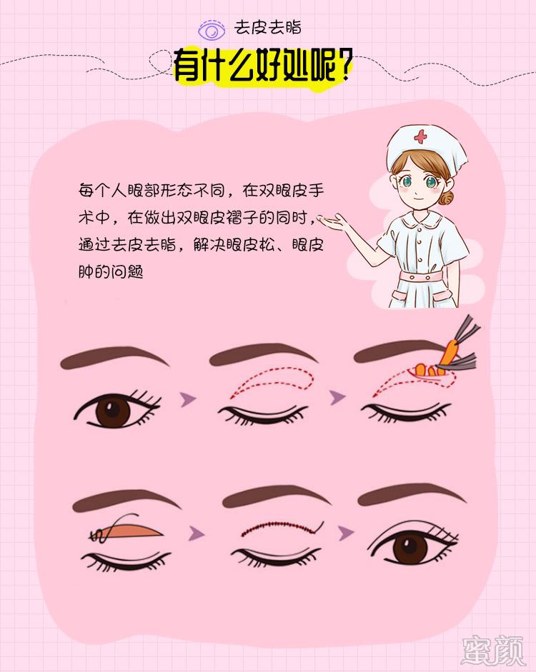 https://img.yiyiaimei.com/mnt/timg/200415/144JJ517-9.jpg