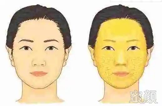 案例图片