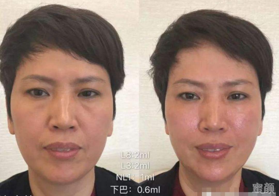 案例图片