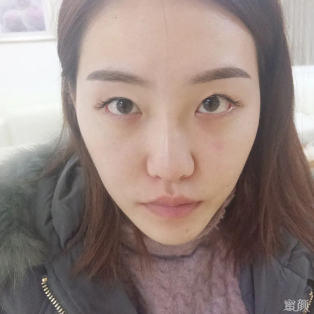 案例图片