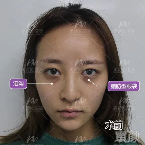案例图片