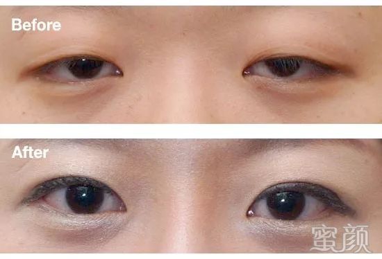 https://img.yiyiaimei.com/mnt/timg/200415/1542141438-2.jpg