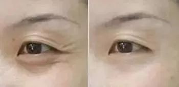 https://img.yiyiaimei.com/mnt/timg/200415/15421531Q-4.jpg