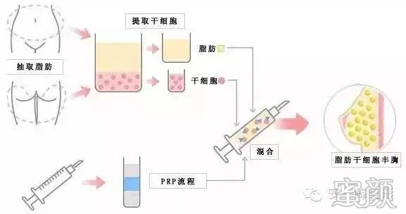 https://img.yiyiaimei.com/mnt/timg/200415/1549392161-2.jpg 案例图片