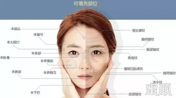 案例图片