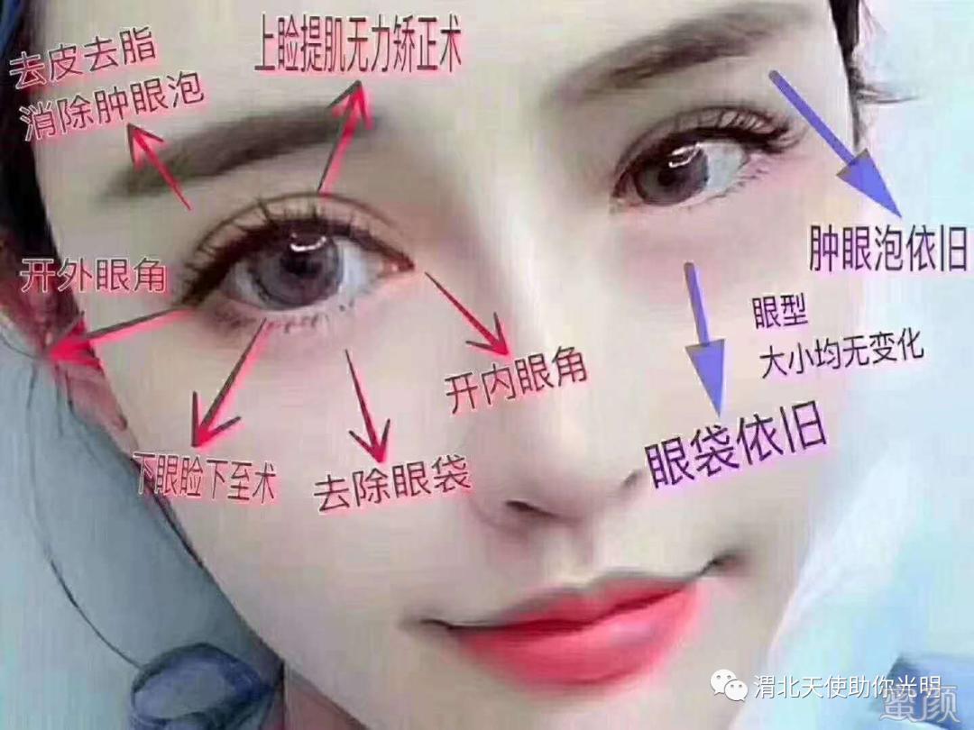 https://img.yiyiaimei.com/mnt/timg/200415/154T431W-2.jpg
