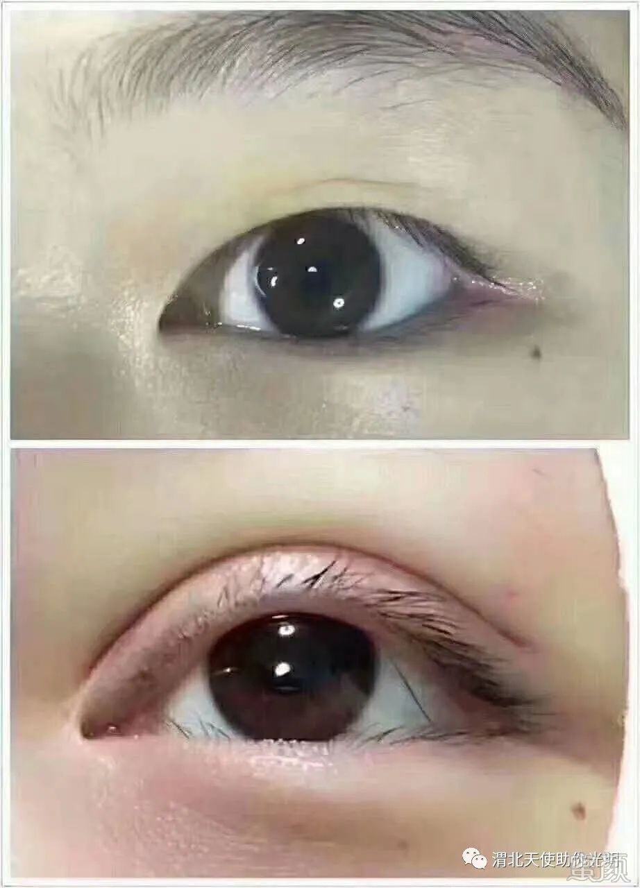 https://img.yiyiaimei.com/mnt/timg/200415/154TC5a-3.jpg