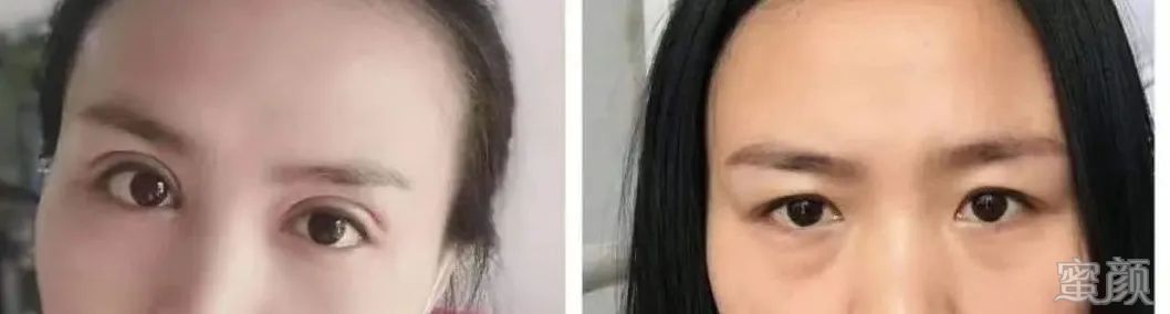 https://img.yiyiaimei.com/mnt/timg/200415/154TJS2-4.jpg