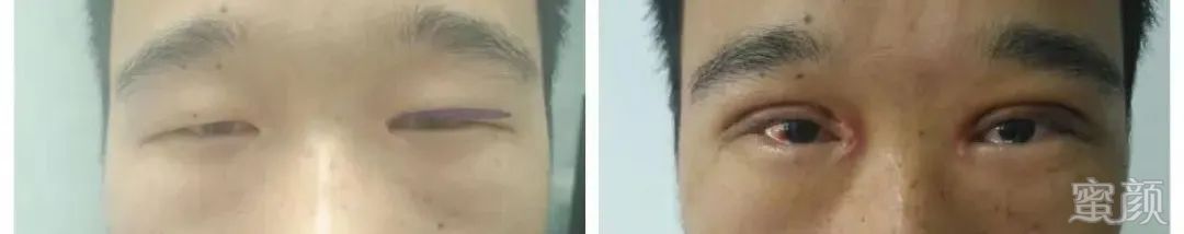 https://img.yiyiaimei.com/mnt/timg/200415/154TWO1-7.jpg