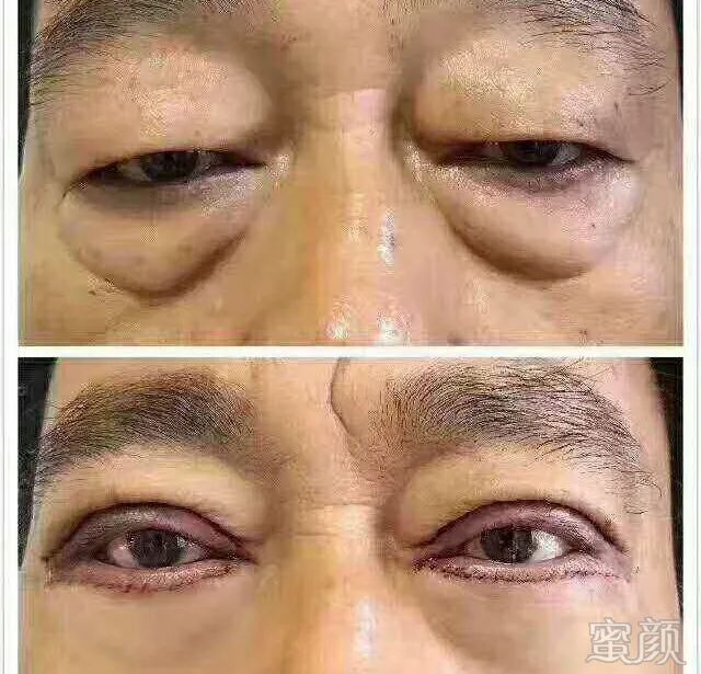 https://img.yiyiaimei.com/mnt/timg/200415/154U03426-9.jpg