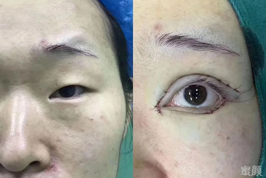 https://img.yiyiaimei.com/mnt/timg/200415/154U114Y-10.jpg