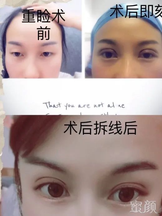 https://img.yiyiaimei.com/mnt/timg/200415/154U22R1-12.jpg