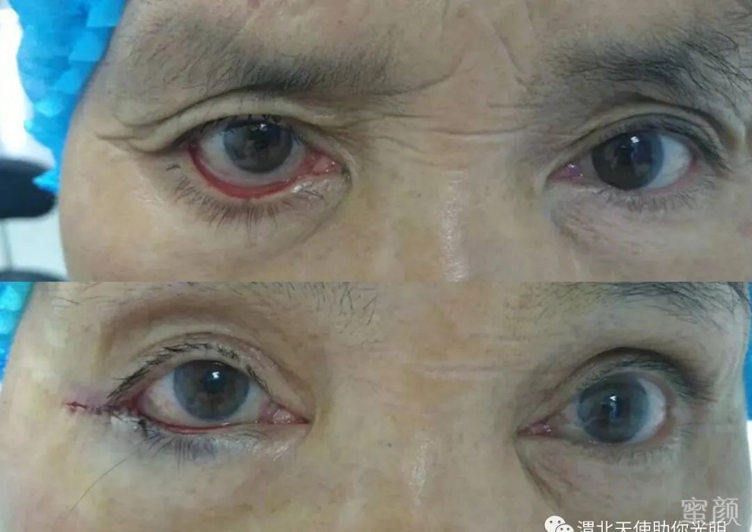 https://img.yiyiaimei.com/mnt/timg/200415/154U2Db-11.jpg