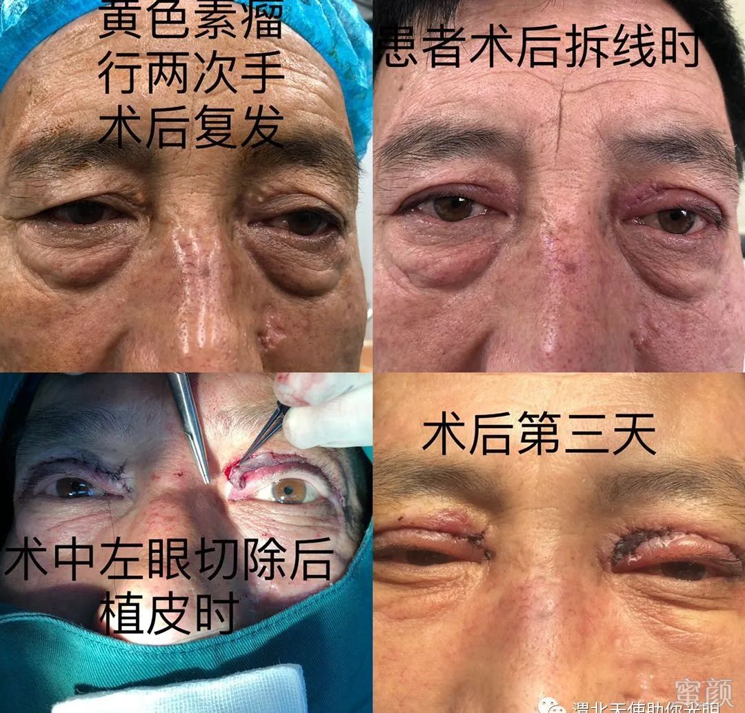 https://img.yiyiaimei.com/mnt/timg/200415/154UB493-15.jpg