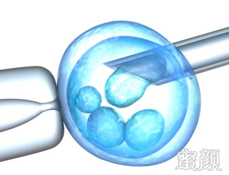 https://img.yiyiaimei.com/mnt/timg/200416/1439355E9-0.jpg 案例图片