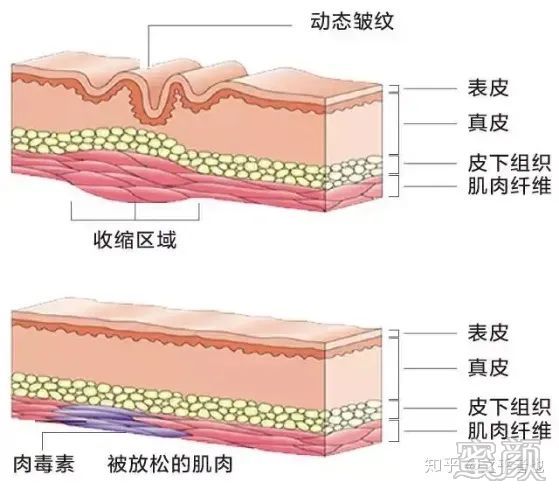 https://img.yiyiaimei.com/mnt/timg/200416/150IM553-5.jpg