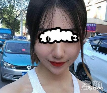 案例图片