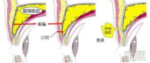 案例图片