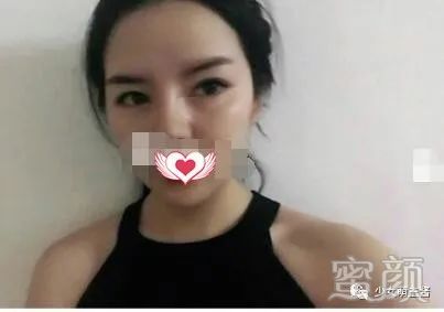 案例图片