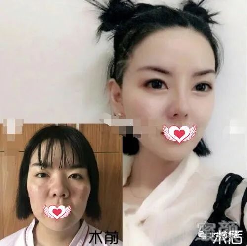 案例图片