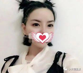 案例图片