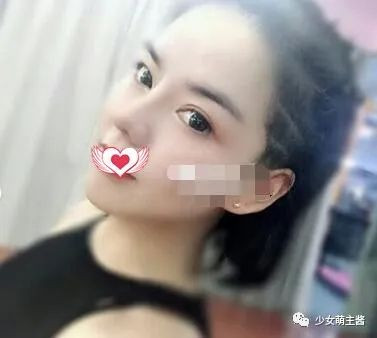 案例图片