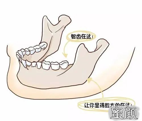 案例图片