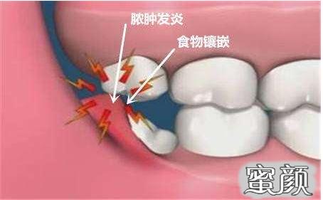 案例图片