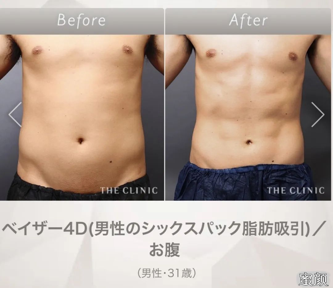 https://img.yiyiaimei.com/mnt/timg/200417/1333441039-3.jpg 案例图片