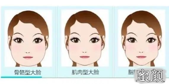 https://img.yiyiaimei.com/mnt/timg/200417/13344UI6-1.jpg 案例图片
