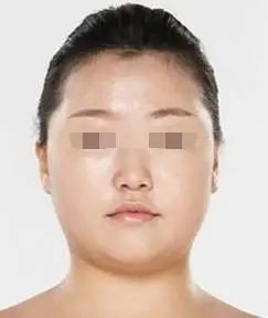 https://img.yiyiaimei.com/mnt/timg/200417/13344UX0-2.jpg 案例图片