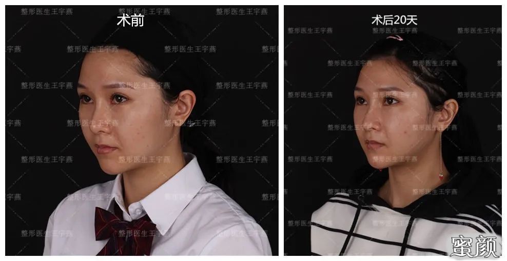 https://img.yiyiaimei.com/mnt/timg/200417/1334504416-4.jpg 案例图片
