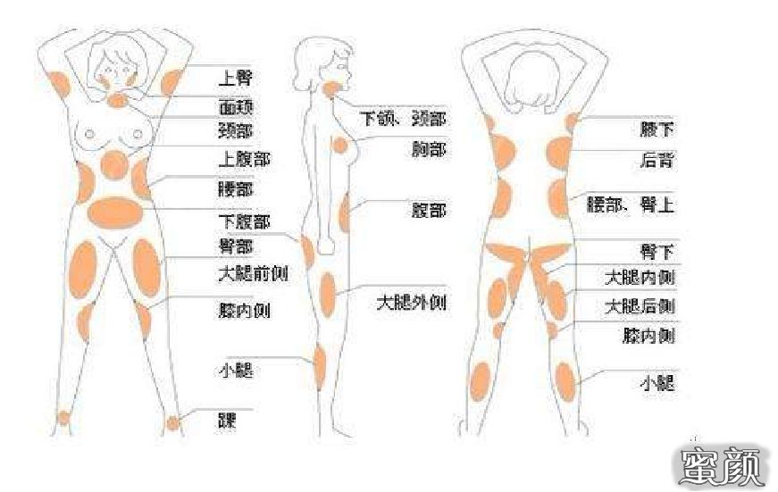 案例图片
