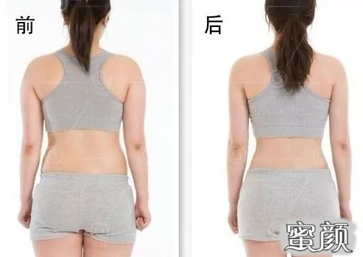 案例图片