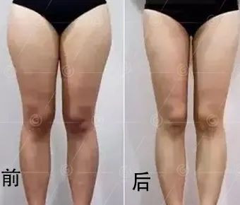 案例图片