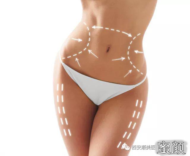 https://img.yiyiaimei.com/mnt/timg/200417/1342452U5-5.jpg