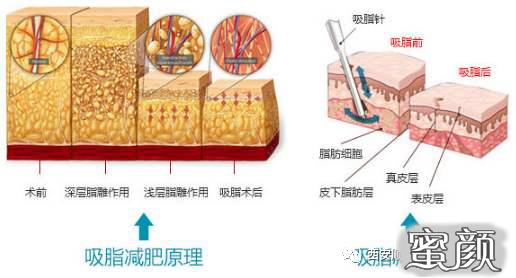 https://img.yiyiaimei.com/mnt/timg/200417/134251K26-8.jpg