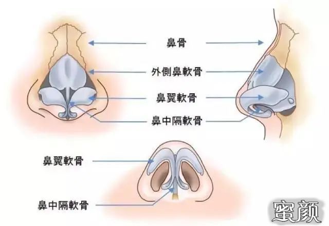 案例图片