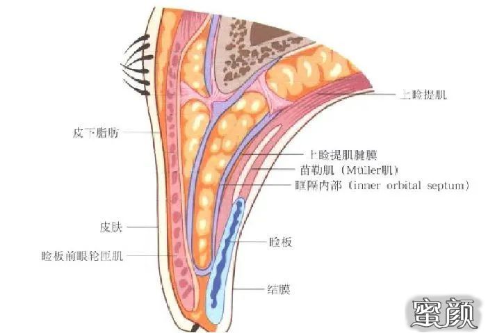 案例图片