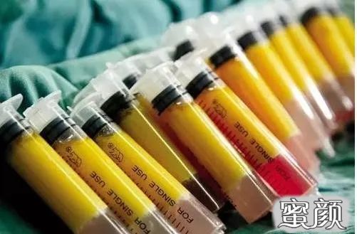 https://img.yiyiaimei.com/mnt/timg/200417/141G244G-2.jpg