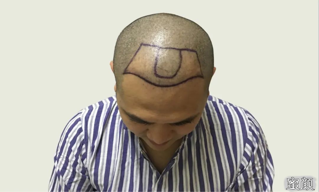 https://img.yiyiaimei.com/mnt/timg/200417/142311K22-2.jpg
